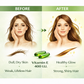 Vitamin E 400 I.U. Softgel Capsules – Natural Antioxidant Support